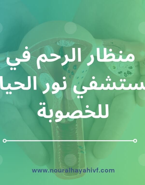 منظار الرحم بمستشفي نور الحياة