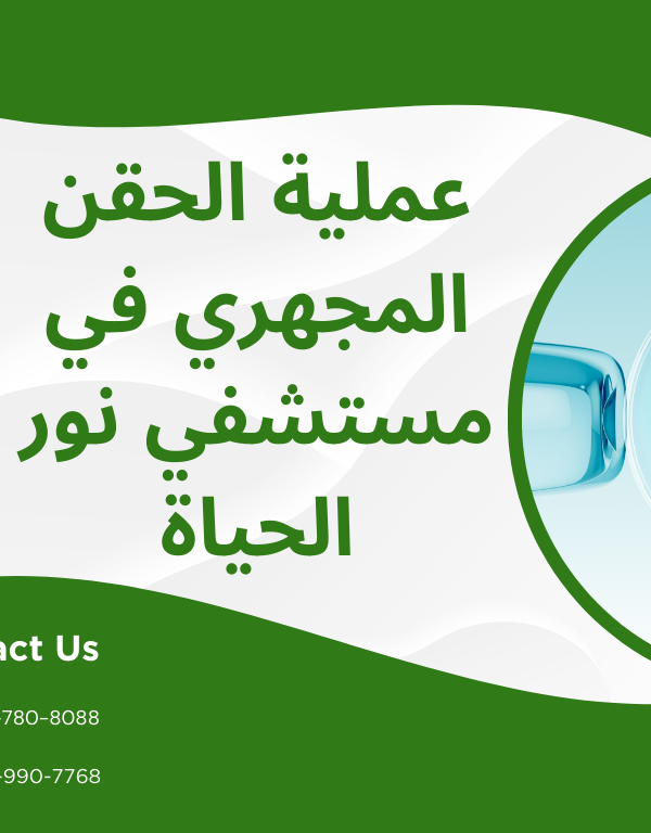 عملية الحقن المجهري