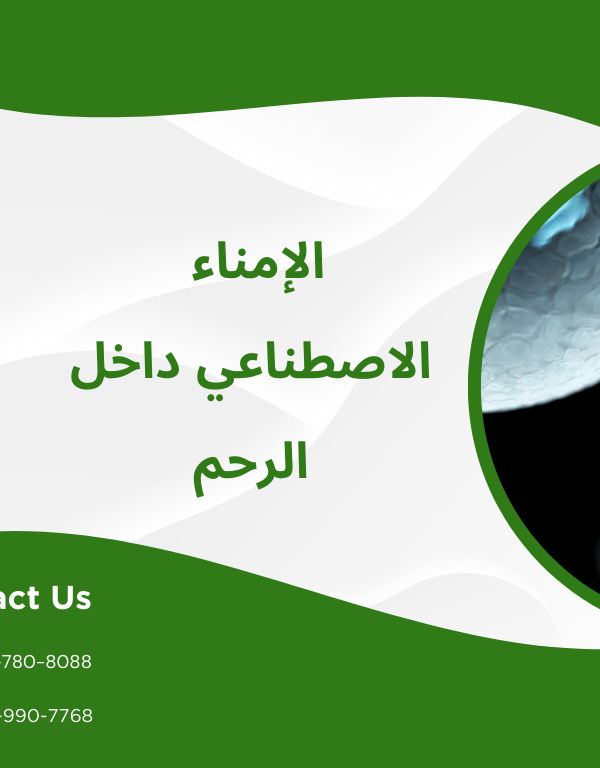 الإمناء الاصطناعي داخل الرحم