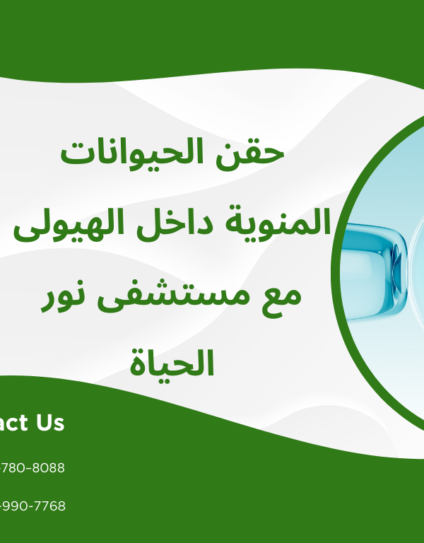 حقن الحيوانات المنوية