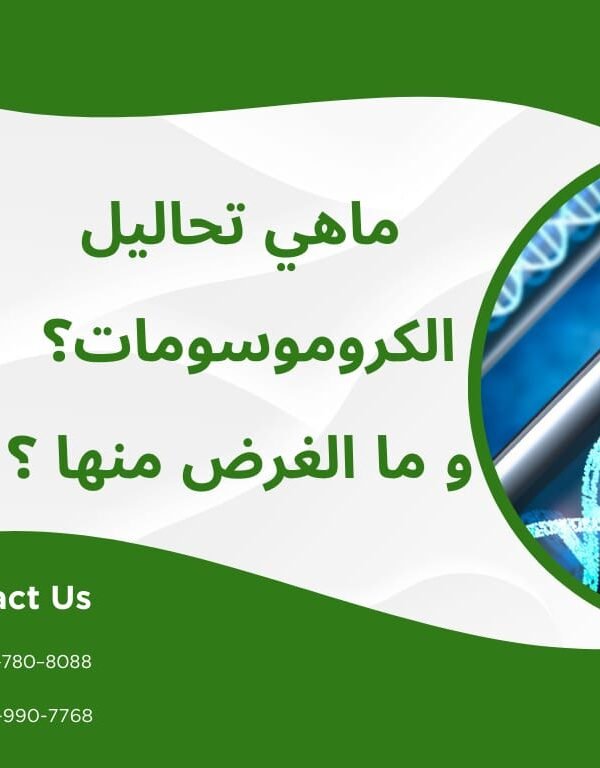 تحليل الكروموسومات