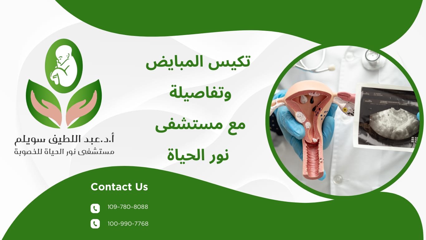 تكيس المبايض وتفاصيله